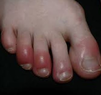 Nikoh fohishalikning bir shakli sifatida