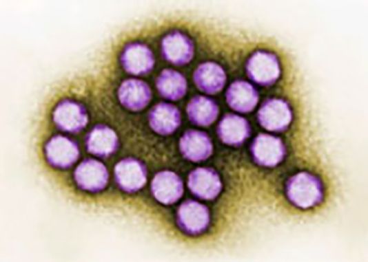 F88d91e1 Ee64 45aa 851d 9fdcdcf27bc7 Adenovirus