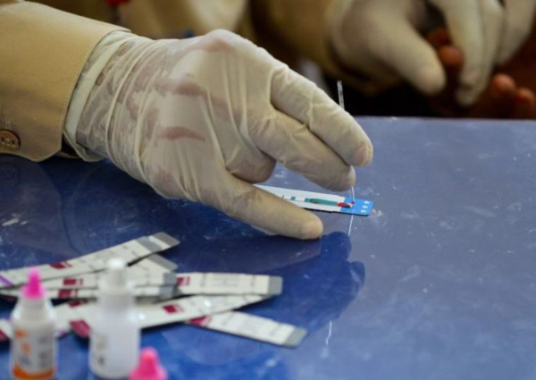 Obsh Infeksione Seksualisht Te Transmetueshme