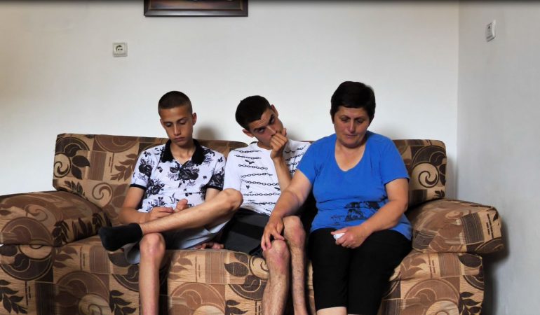 Shqiptaret Per Shqiptaret Djali Me Skolioze