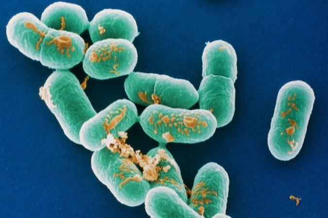 Who Listeria Outbreaks In South Africa The Largest In Record