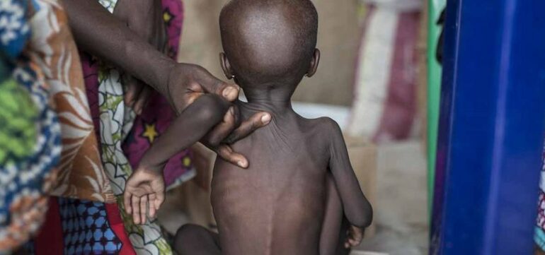 806x378 At Least 652 Children Died From Malnutrition In Nigeria In Last Six Months Msf 1753468168457