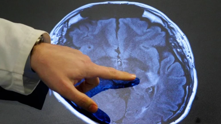 F39b7933 Ap111028128614