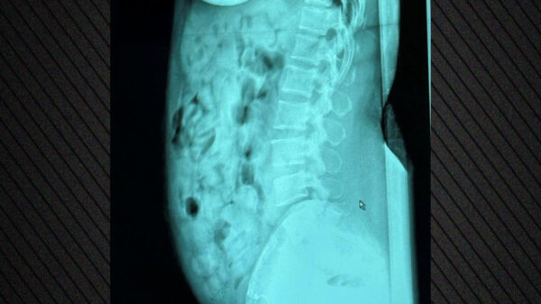 Xrwma Bergamo Aerodromio