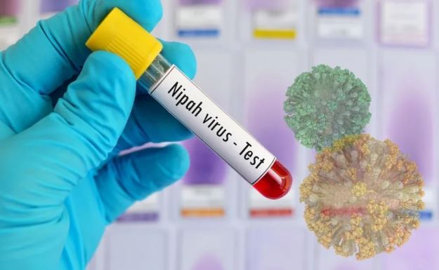 Çfarë është virusi Nipah dhe pse po alarmon botën 