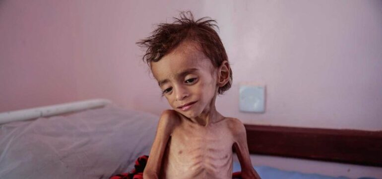 Një E Treta E Ushqimit