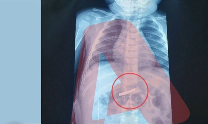 e-frikshme-3-vjecari-gelltit-briskun-e-rrojes