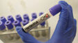 Hantavirus1