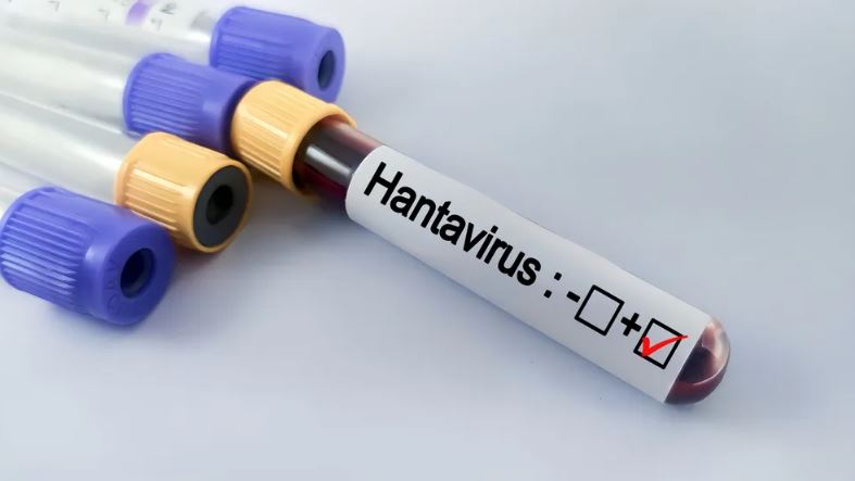 Hantavirus në anije: Rreziku i një pandemie të re? Çfarë duhet të dini
