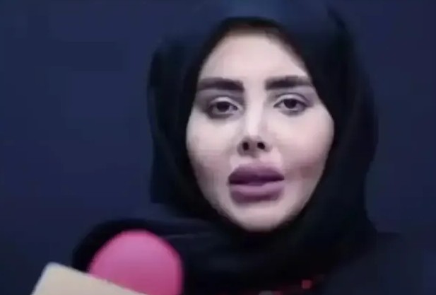 foto galeri 
