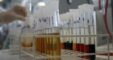 Antidoping Test (1)