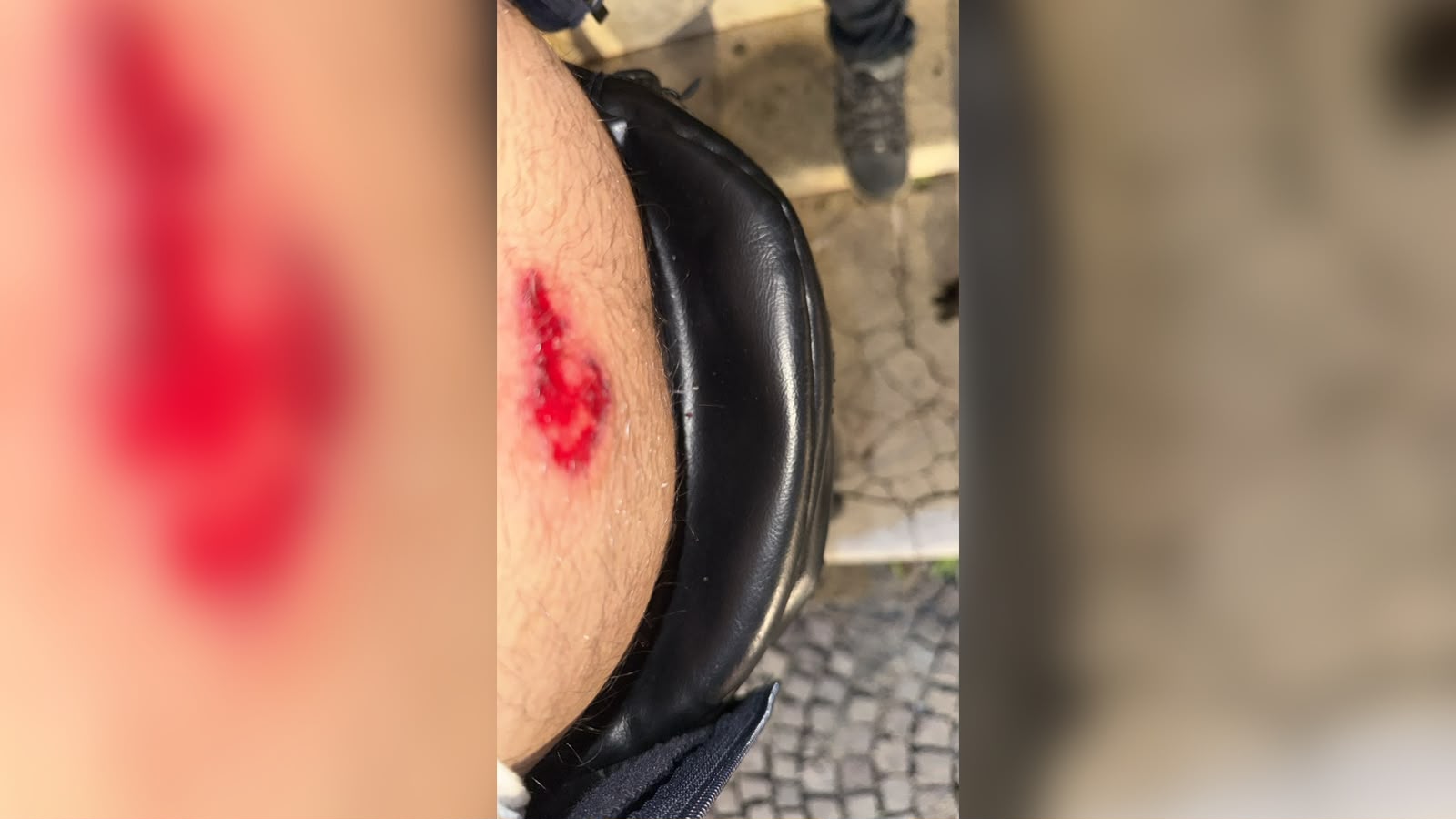 Lëndohet operatori i News24/ Elvin Kamberi mbetet i dëmtuar gjatë përplasjes me policinë ndërsa xhironte në terren