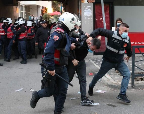 “U goditën edhe kalimtarë”/ Dhuna në protestë, Ministria e Shëndetësisë: 6 persona po marrin trajtim te Trauma