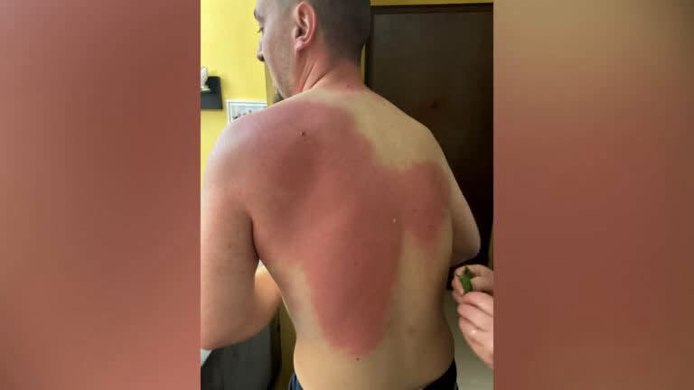 Klevi Muka Protesta 1