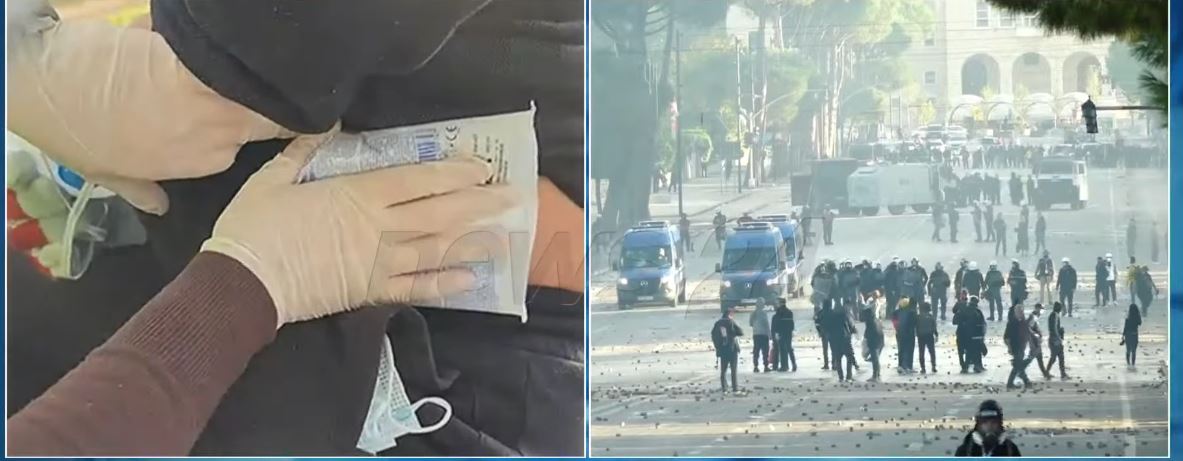 VIDEO  Qytetari qëllohet nga policia me plumb gome në pjesën e barkut