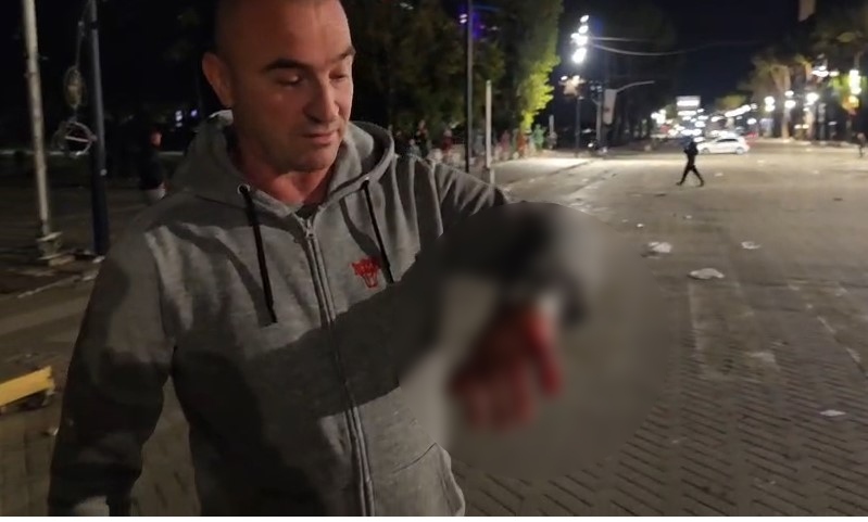  Më gjuajtën me gurë dhe më hodhën gaz në sy   protestuesi tregon dhunën nga policia  Do të vij sërish  kërkojmë të drejtat to   