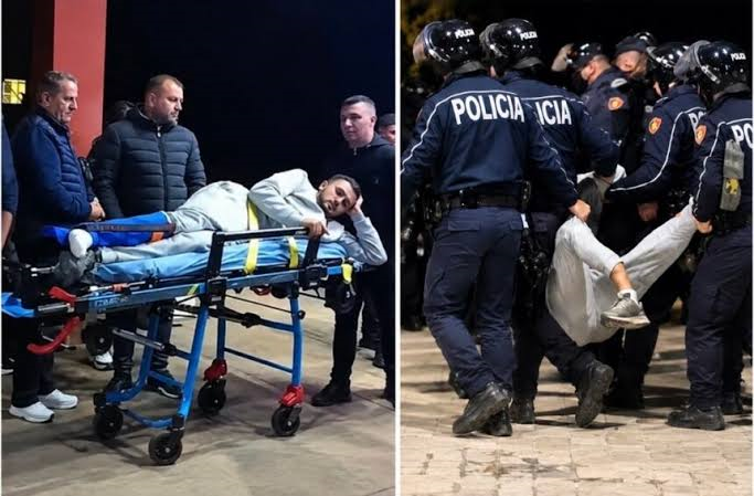 Foto nga burimi: Protestat! Njërit të ri iu thye këmba, tjetri pësoi dëmtime në kafkë, Prokuroria e Tiranës nis hetimet për veprimet e policisë