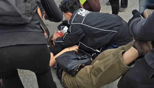 VIDEO  Protestuesja goditet nga gazi lotsjellës në fytyrë  dërgohet e gjakosur te Spitali i Traumës