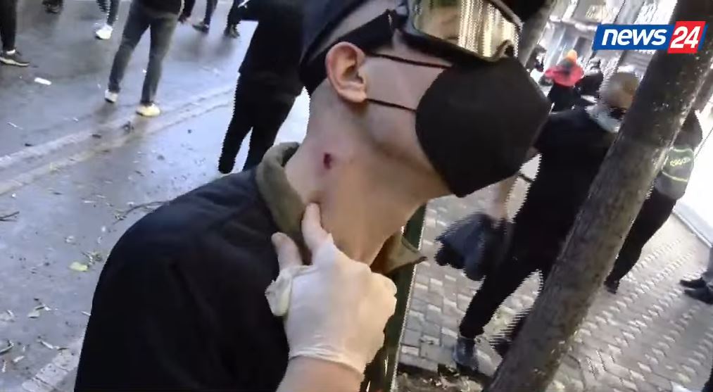 Foto nga burimi: Pamje të rënda! Policia qëlloi me plumba gome, i riu me plagë në qafë